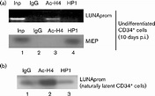 The latent UL81–82as promoter is associated with acetylated histone H4 ...