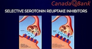 Selective Serotonin Reuptake Inhibitors (SSRIs)