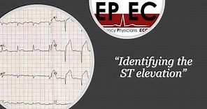 ECG Tip 1. Where is the isoelectric line?