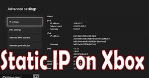 How to Setup Static IP on Xbox One
