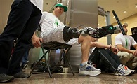 Amputee Zac Vawter Fitted With First Thought-Controlled Bionic Leg