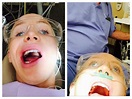 Wisdom Teeth General Anesthesia – Boston Dentist – Congress Dental ...