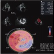 The baseline two-dimensional echocardiography and three-dimensional ...