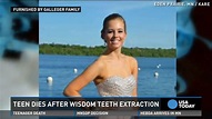 Teen dies after routine wisdom tooth extraction