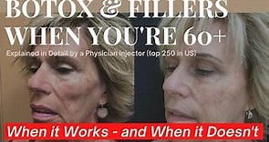 Botox & Filler Over 60: When It Works & When It Just Doesn t Cut It Anymore