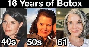 My 16 Year Botox Journey for Preventing Wrinkles | Anti-aging Strategies for 40s, 50s, and 60s