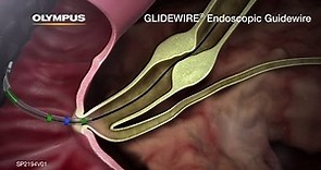GLIDEWIRE Endoscopic Hydrophilic Coated Guidewire Animation