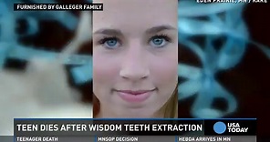 Teen dies after routine wisdom tooth extraction
