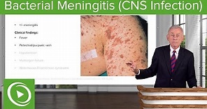 Bacterial Meningitis (CNS Infection) – Infectious Diseases | Lecturio