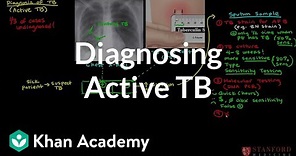 Diagnosing active TB | Infectious diseases | NCLEX-RN | Khan Academy
