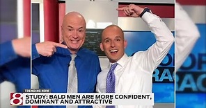 Study: bald men are more confident, dominant and attractive