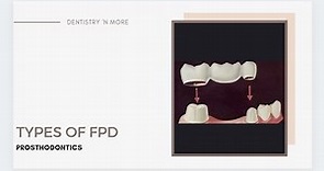 TYPES OF FPD